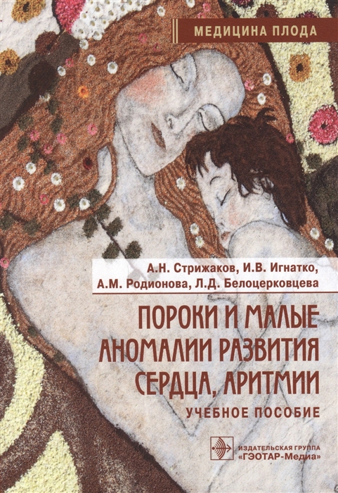 Стрижаков А., Игнатко И., Родионова А., Белоцерковцева Л. - Пороки и малые аномалии развития сердца аритмии