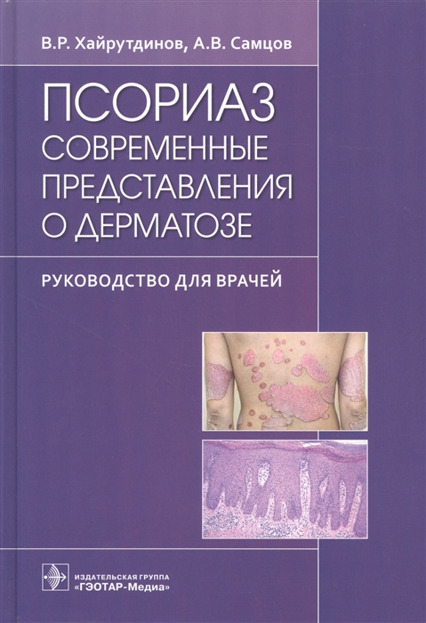 Хайрутдинов В., Самцов А. - Псориаз Современные представления о дерматозе Руководство для врачей