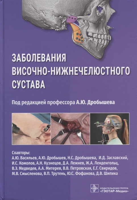 

Заболевания височно-нижнечелюстного сустава