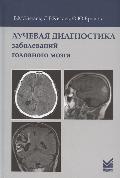 Китаев В., Китаев С., Бронов О. - Лучевая диагностика заболеваний головного мозга 3-е издание