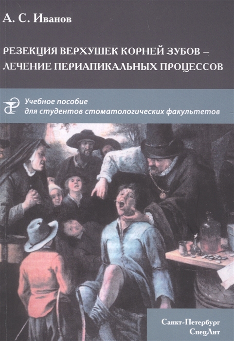 

Резекция верхушек корней зубов - лечение периапикальных процессов