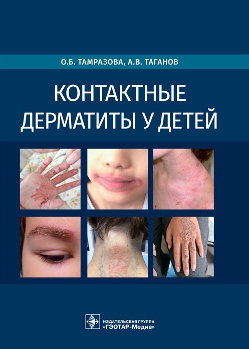

Контактные дерматиты у детей