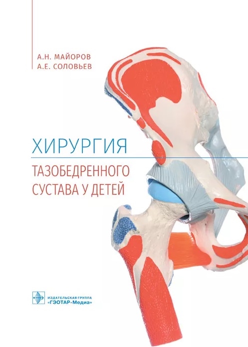 

Хирургия тазобедренного сустава у детей