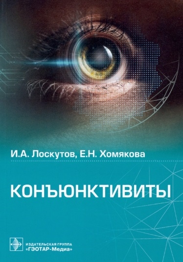 

Конъюнктивиты