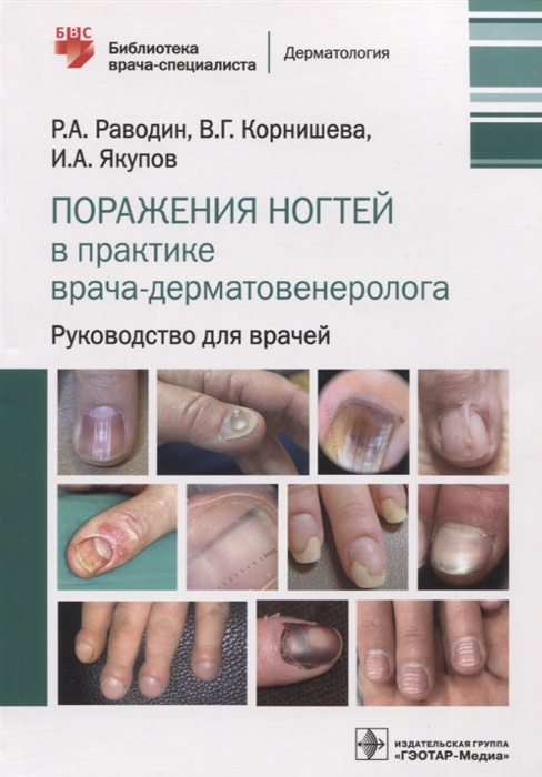 

Поражения ногтей в практике врача-дерматовенеролога руководство для врачей