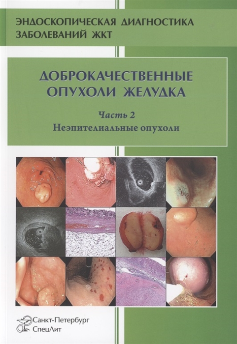 

Доброкачественные опухоли желудка Часть 2 Неэпителиальные опухоли
