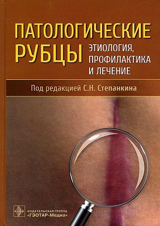 

Патологические рубцы Этиология профилактика и лечение