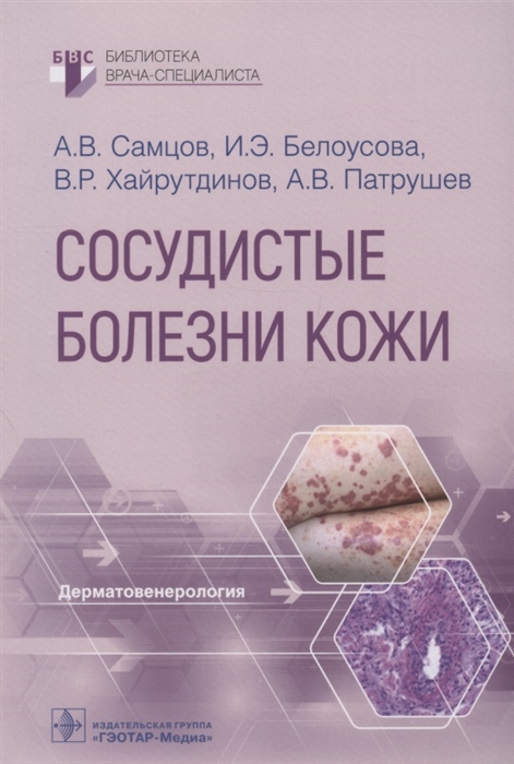 

Сосудистые болезни кожи