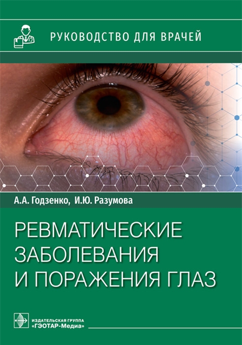 

Ревматические заболевания и поражения глаз руководство для врачей