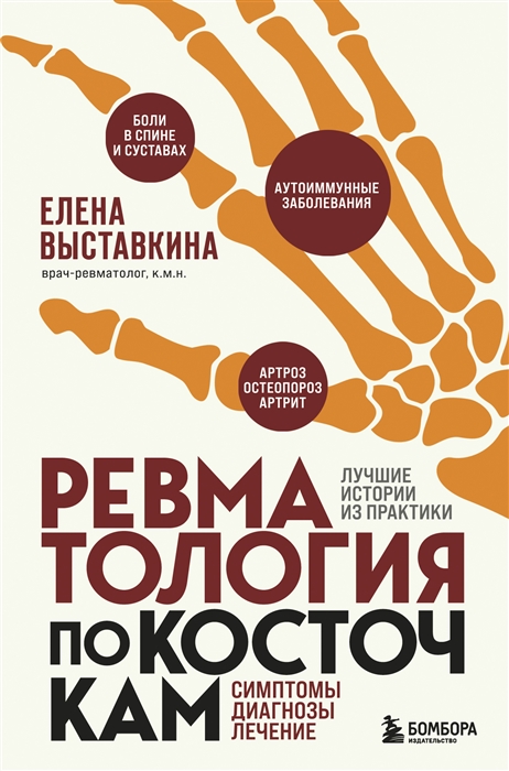

Ревматология по косточкам Симптомы диагнозы лечение