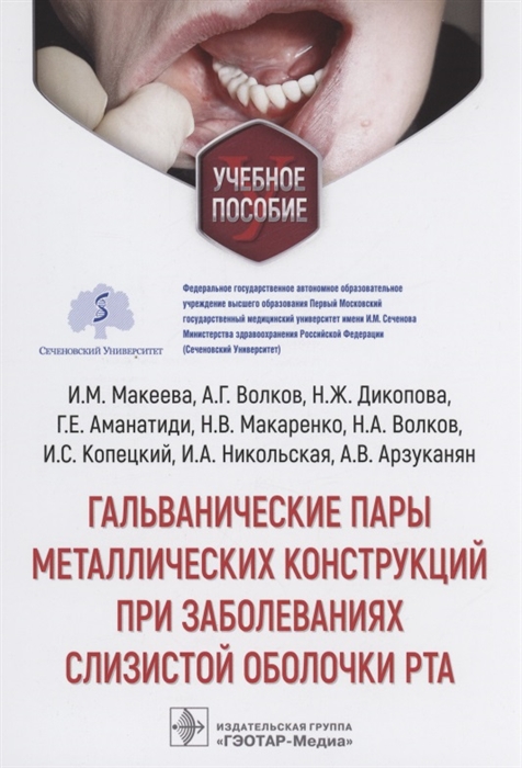 

Гальванические пары металлических конструкций при заболеваниях слизистой оболочки рта учебное пособие