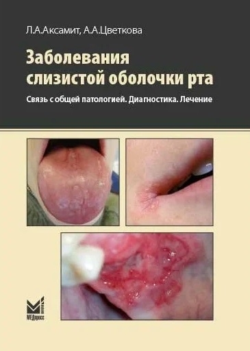 

Заболевания слизистой оболочки рта Связь с общей патологией Диагностика Лечение