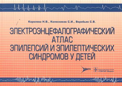 Электроэнцефалографический атлас эпилепсий